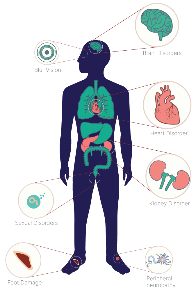 major complications of diabetes
